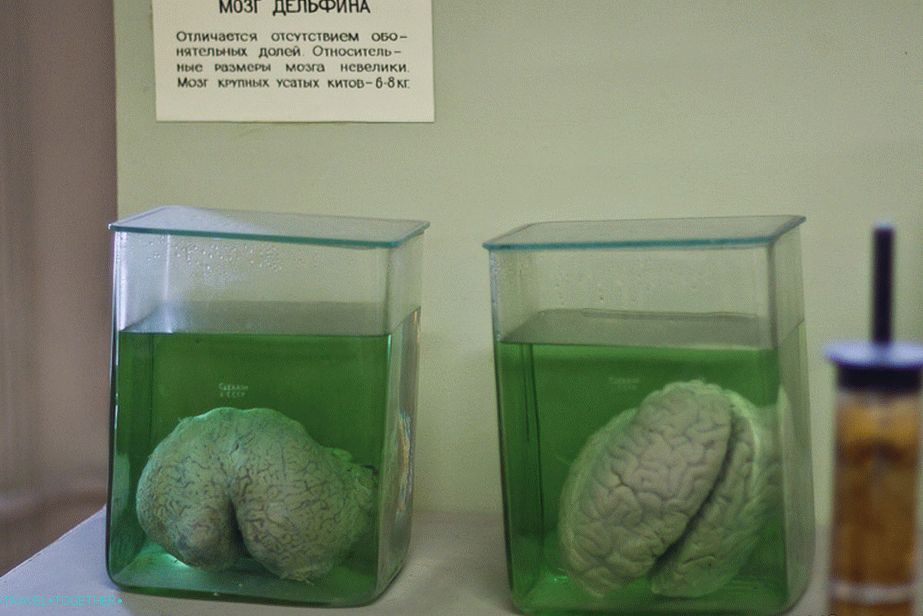 The brain of a dolphin and a man, find 10 differences
